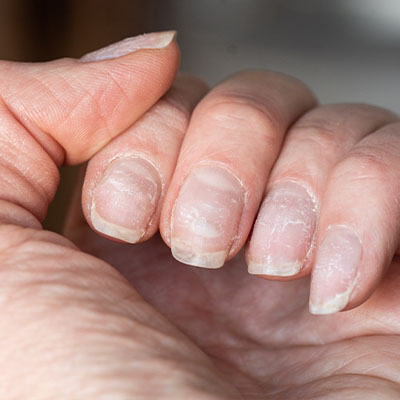 MANI ROVINATE MANI ROVINATE